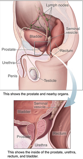 Prostaat