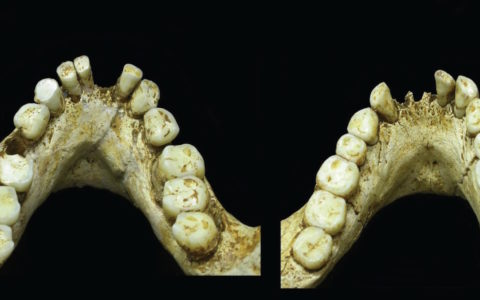 Onderkaak Homo floriensis
